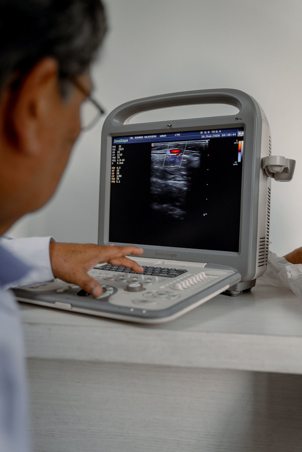 Pantalla del Eco Doppler mostrando el flujo de la sangre